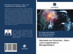 Nachweis von Knochen-, Haut- und Lungenkrebs in Röntgenbildern - Jadhav, Dr. Jagannath;Chamakeri, Dr. Puneet;Gurav, Praveen