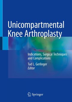 Unicompartmental Knee Arthroplasty