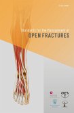 Standards for the Management of Open Fractures (eBook, ePUB)