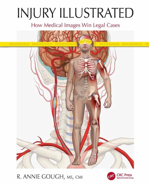 Injury Illustrated (eBook, PDF)