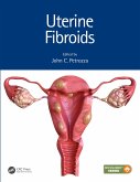Uterine Fibroids (eBook, ePUB)