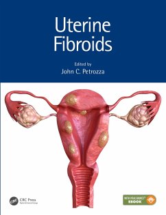 Uterine Fibroids (eBook, ePUB)