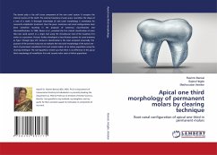 Apical one third morphology of permanent molars by clearing technique