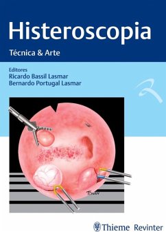 Histeroscopia (eBook, ePUB) - Lasmar, Ricardo Bassil; Lasmar, Bernardo Portugal