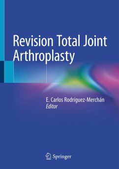 Revision Total Joint Arthroplasty