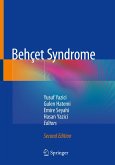 Behçet Syndrome