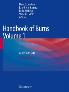 Handbook of Burns Volume 1