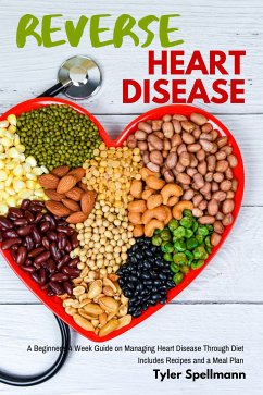 Reverse Heart Disease (eBook, ePUB) - Spellmann, Tyler