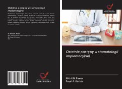 Ostatnie post¿py w stomatologii implantacyjnej - Pawar, Nikhil N.; Karkar, Payal A.