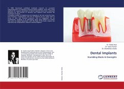 Dental Implants - Arya, Dr. Geeta;Kumar, Varun;shukla, Dr. Shambhavi