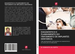 DIAGNÓSTICO E PLANEAMENTO DO TRATAMENTO DE IMPLANTES DENTÁRIOS - LAL GUPTA, Dr KANHAIYA