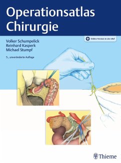Operationsatlas Chirurgie (eBook, PDF) - Schumpelick, Volker; Kasperk, Reinhard; Stumpf, Michael