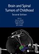 Brain and Spinal Tumors of Childhood... - Bild 1