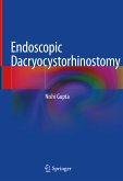 Endoscopic Dacryocystorhinostomy (eBook, PDF)