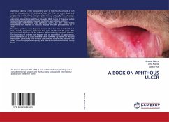 A BOOK ON APHTHOUS ULCER - Mishra, Shweta;Kumar, Amit;Rai, Gaurav