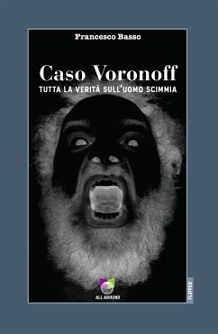 Caso Voronoff (fixed-layout eBook, ePUB) - Basso, Francesco