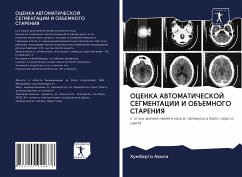 Cover OCENKA AVTOMATIChESKOJ SEGMENTACII I OB#EMNOGO STARENIYa