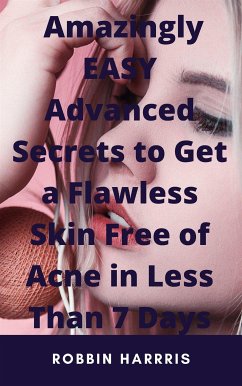 Get a Flawless Skin Free Of Acne In 7 Days Or Less - Works For All Types Of Skin (eBook, ePUB) - Harris, Robbin