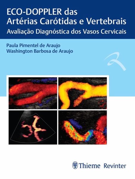 ECO-DOPPLER das Artérias Carótidas e Vertebrais (eBook, ePUB)