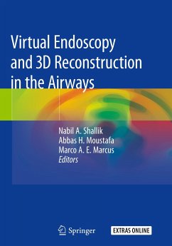 Virtual Endoscopy and 3D Reconstruction in the Airways