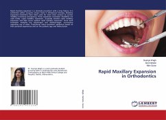Rapid Maxillary Expansion in Orthodontics