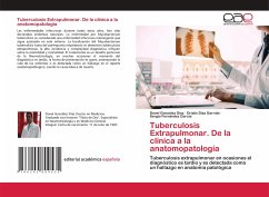 Tuberculosis Extrapulmonar. De la clínica a la anatomopatología - González Díaz, Donel;Díaz Garrido, Drialis;Fernández García, Sergio