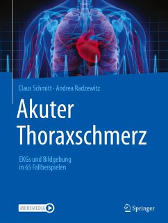 Akuter Thoraxschmerz - Schmitt, Claus;Radzewitz, Andrea