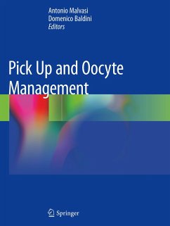 Pick Up and Oocyte Management