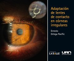 Adaptación de lentes de contacto en córneas irregulares (eBook, PDF) - Ortega Pacific, Ernesto