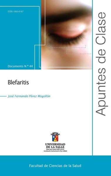 Blefaritis (eBook, PDF) Blefaritis (eBook, PDF)