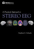 A Practical Approach to Stereo EEG (eBook, ePUB)