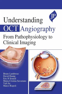 UNDERSTANDING OCT ANGIOGRAPHY FROM PATHOPHYSIOLOGY TO CLINICAL IMAGING - Lumbroso, Bruno