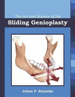 The Art and Science of the Sliding Genioplasty - Reyneke, Johan P.