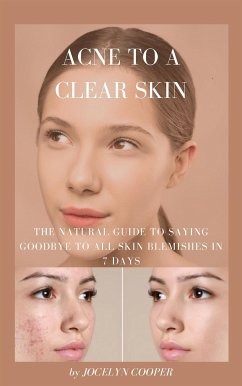 Acne to a Clear Skin: Saying Goodbye to all Skin Blemishes in 7 Days (eBook, ePUB) - COOPER, JOCELYN