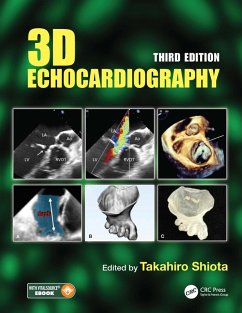 Cover 3D Echocardiography (eBook, PDF)