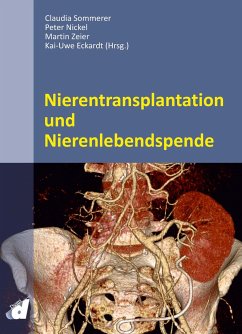 Nierentransplantation und Nierenlebendspende - Sommerer, Claudia;Nickel, Peter;Zeier, Martin