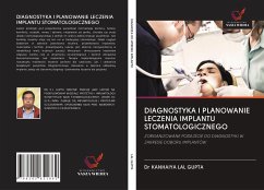 DIAGNOSTYKA I PLANOWANIE LECZENIA IMPLANTU STOMATOLOGICZNEGO - Lal Gupta, Kanhaiya