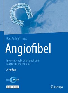 Angiofibel (eBook, PDF)