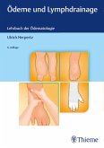 Ödeme und Lymphdrainage (eBook, ePUB)
