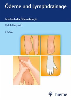 Ödeme und Lymphdrainage (eBook, ePUB) - Herpertz, Ulrich