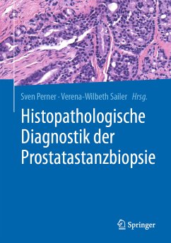 Histopathologische Diagnostik der Prostatastanzbiopsie (eBook, PDF) - Perner, Sven