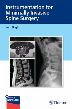 Cover Instrumentation for Minimally Invasive Spine Surgery (eBook, PDF)