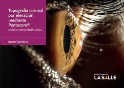 Cover Topografía corneal por elevación mediante Pentacam® (eBook, PDF)