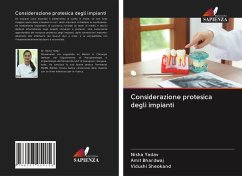 Considerazione protesica degli impianti - Yadav, Nisha;Bhardwaj, Amit;Sheokand, Vidushi