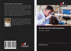 Guasti dentali dell'impianto - Kore, Abhijeet