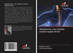 Osteoporosi: una malattia classica legata all'età - Gusain, Neelam;Kanyal Butola, Lata