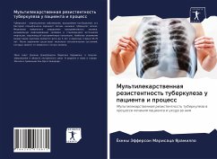 Mul'tilekarstwennaq rezistentnost' tuberkuleza u pacienta i process - Marisaca Yaramillo, Johnny Jefferson