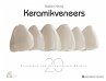 Keramikveneers (eBook, ePUB) - Bild 1