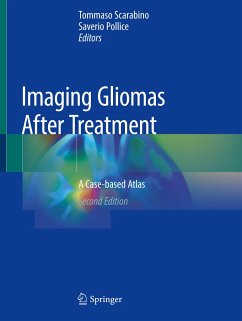 Imaging Gliomas After Treatment