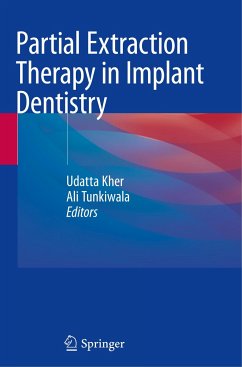 Partial Extraction Therapy in Implant Dentistry